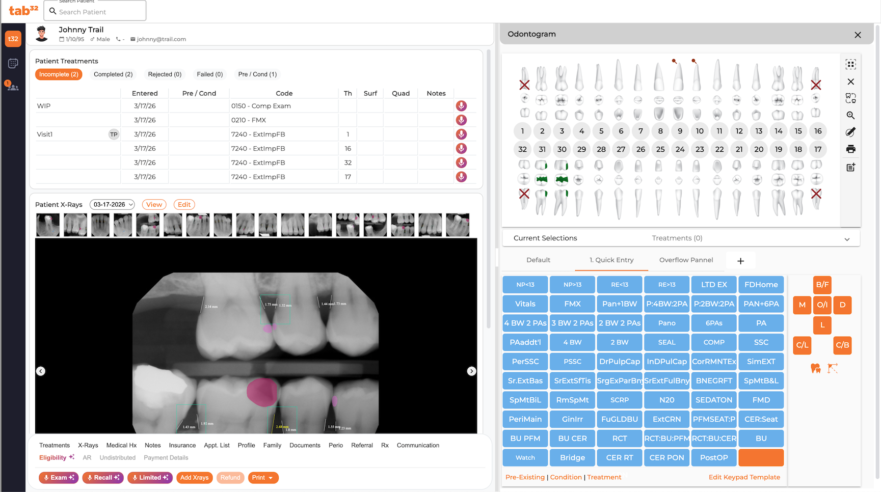 tab32 Clinical Charting and Treatment Planning