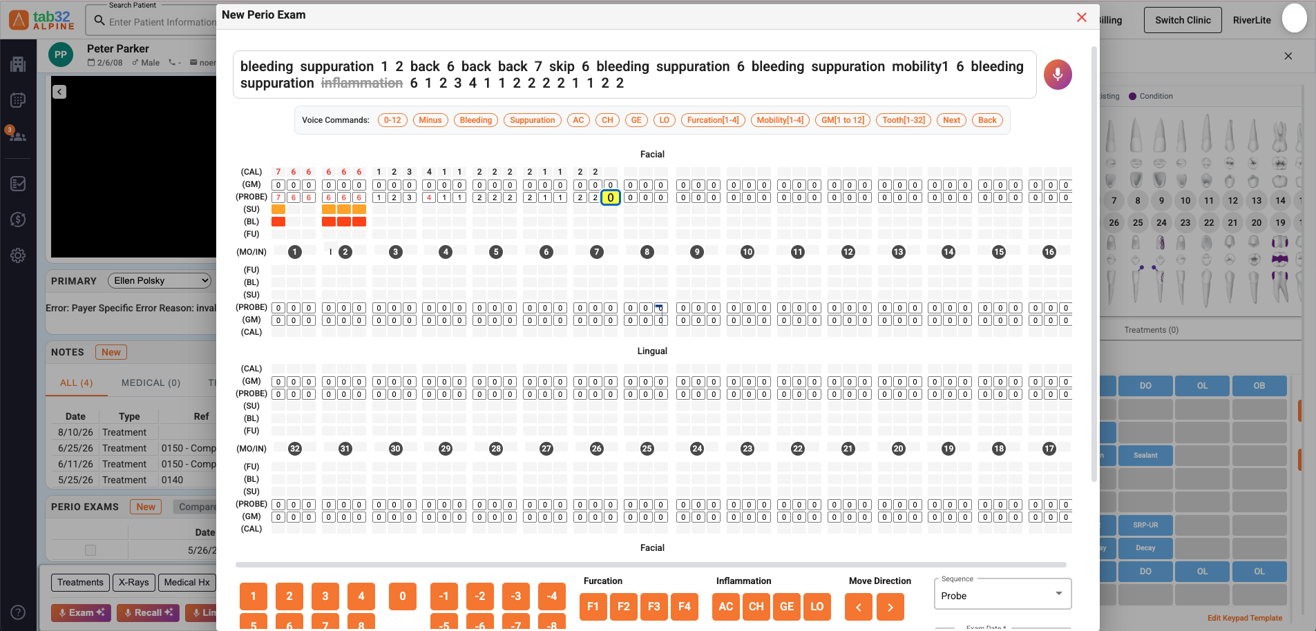 tab32 Voice-Powered Perio Charting